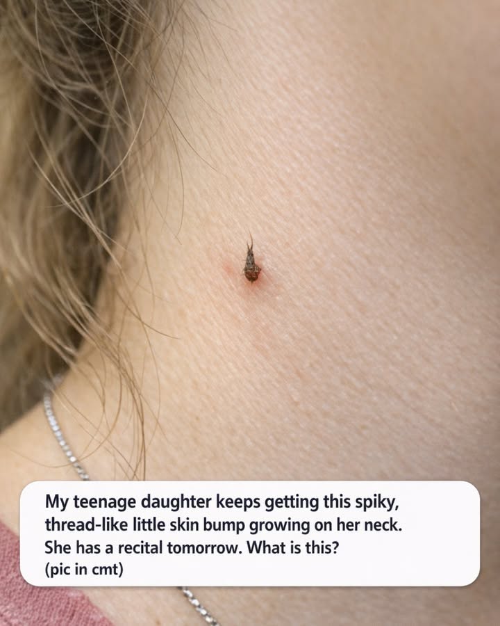A Spiky Little Bump Appeared on My Daughter's Neck Right Before Her Big Recital - Here's What It Actually Was