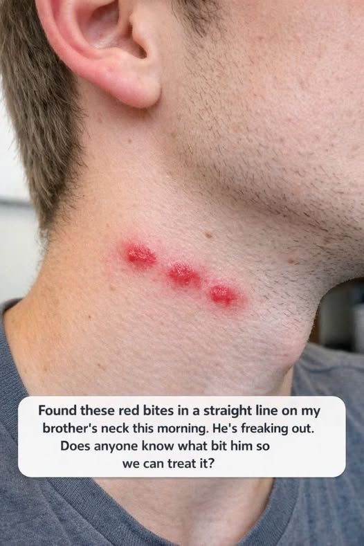 Red Bites in a Perfect Straight Line? Why That Pattern Usually Points to One Specific Pest
