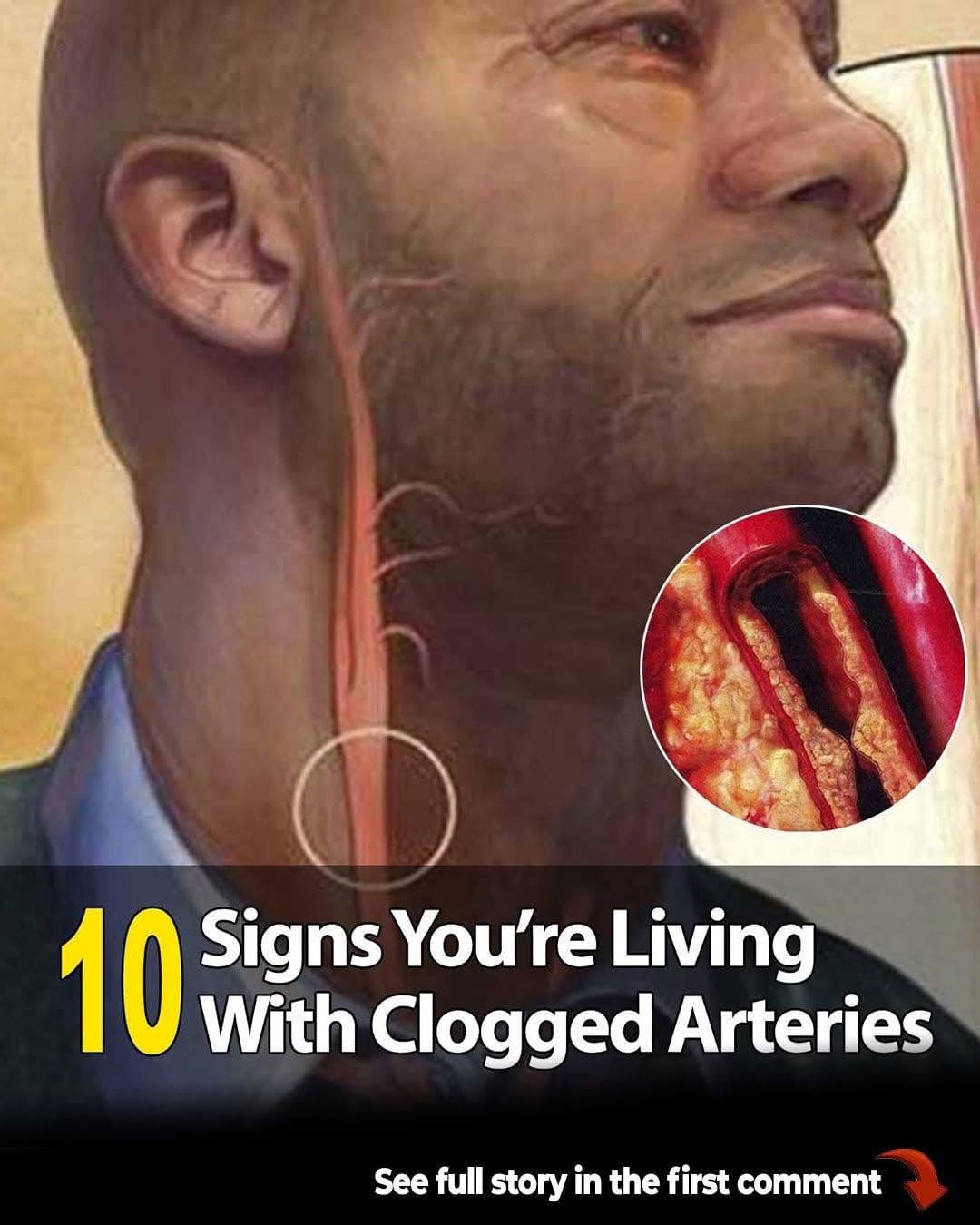 10 Warning Signs Your Arteries May Be Clogged – From Nausea to Numbness You Should Never Ignore