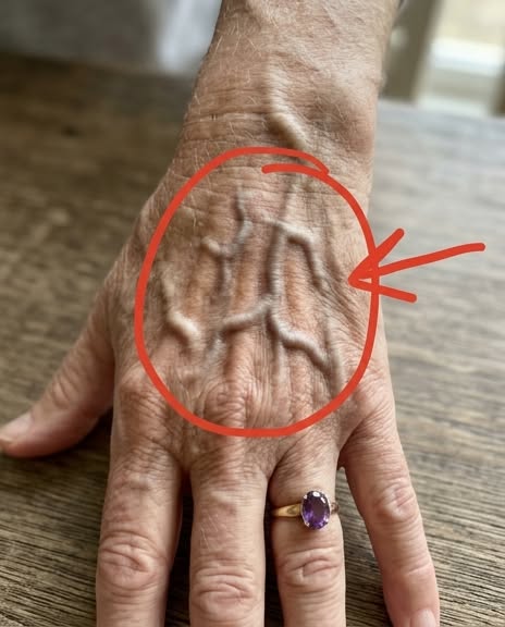 Before You Panic About Visible Veins, Read What Your Body Is Actually Telling You