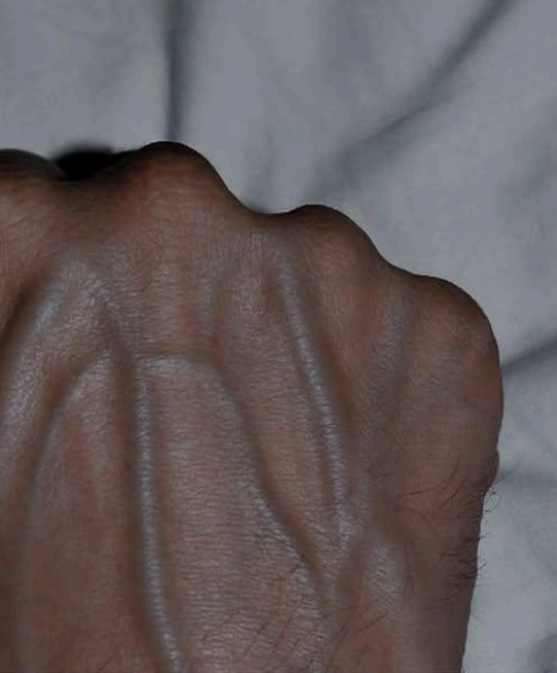 Your Veins Are Suddenly Showing - What Your Body Might Be Trying to Tell You