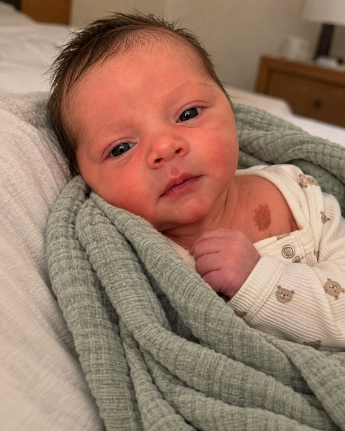 After Ten Years of Miscarriages, Our Daughter Was Finally Born - Then My Husband Saw the Birthmark and Turned White as a Sheet