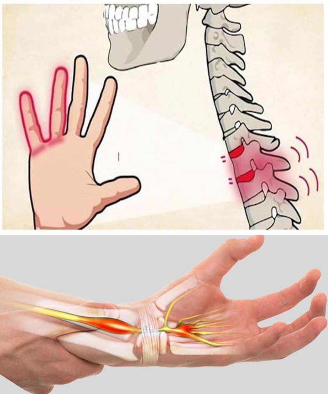 Why Your Hands Keep Going Numb - and the Warning Signs You Should Never Ignore