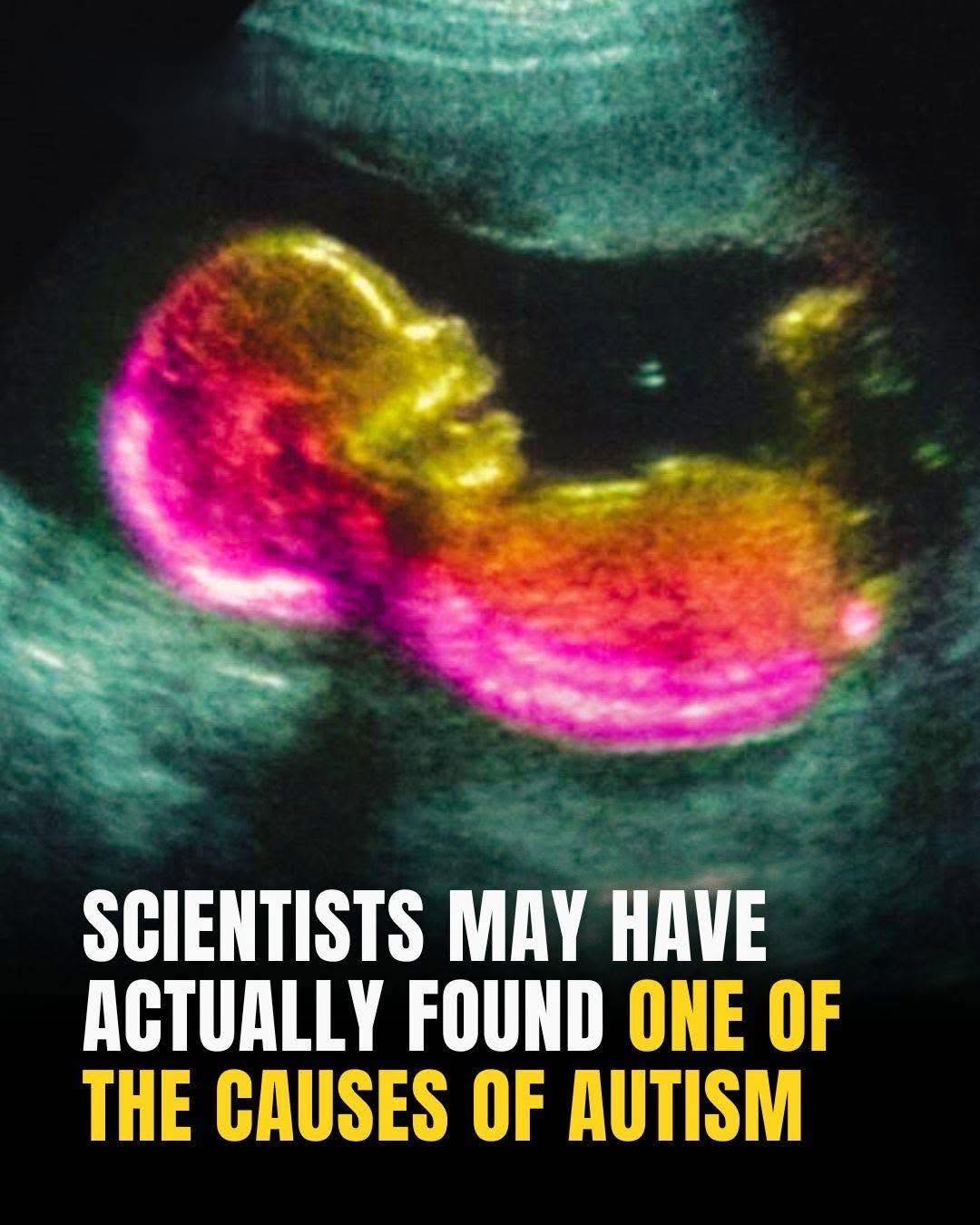 Could Gut Bacteria Influence Autism? A New Study Points to the Mother's Microbiome